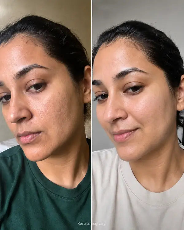 Before and after result