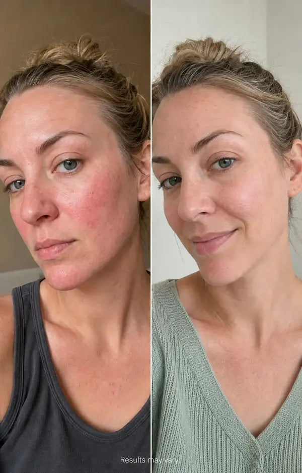 Before and after result