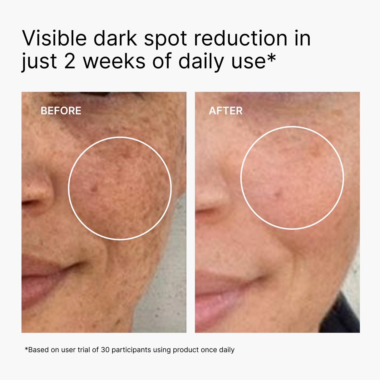 Korean Blemish Toner Pads 200mL (120 pads)