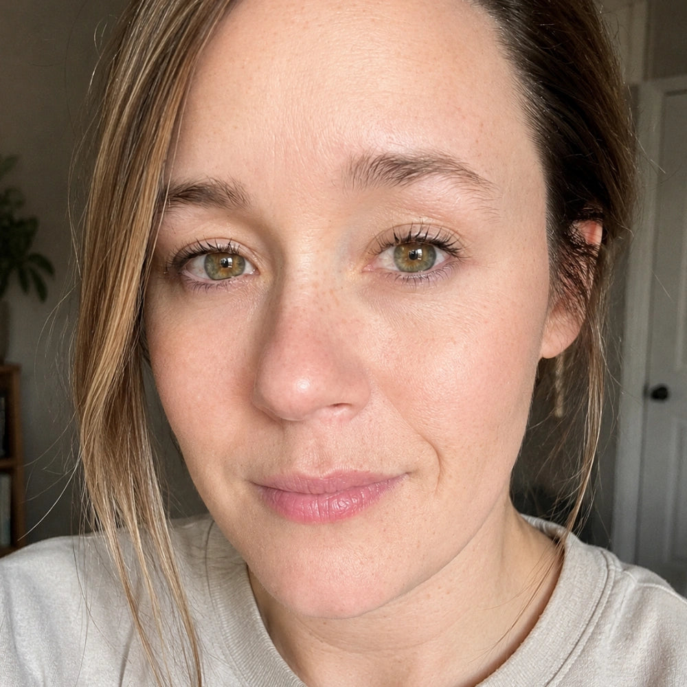 Joy, 38 — after 8 weeks, softened fine lines