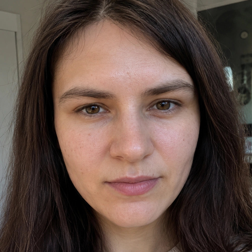 Keisha, 33 — before, uneven texture