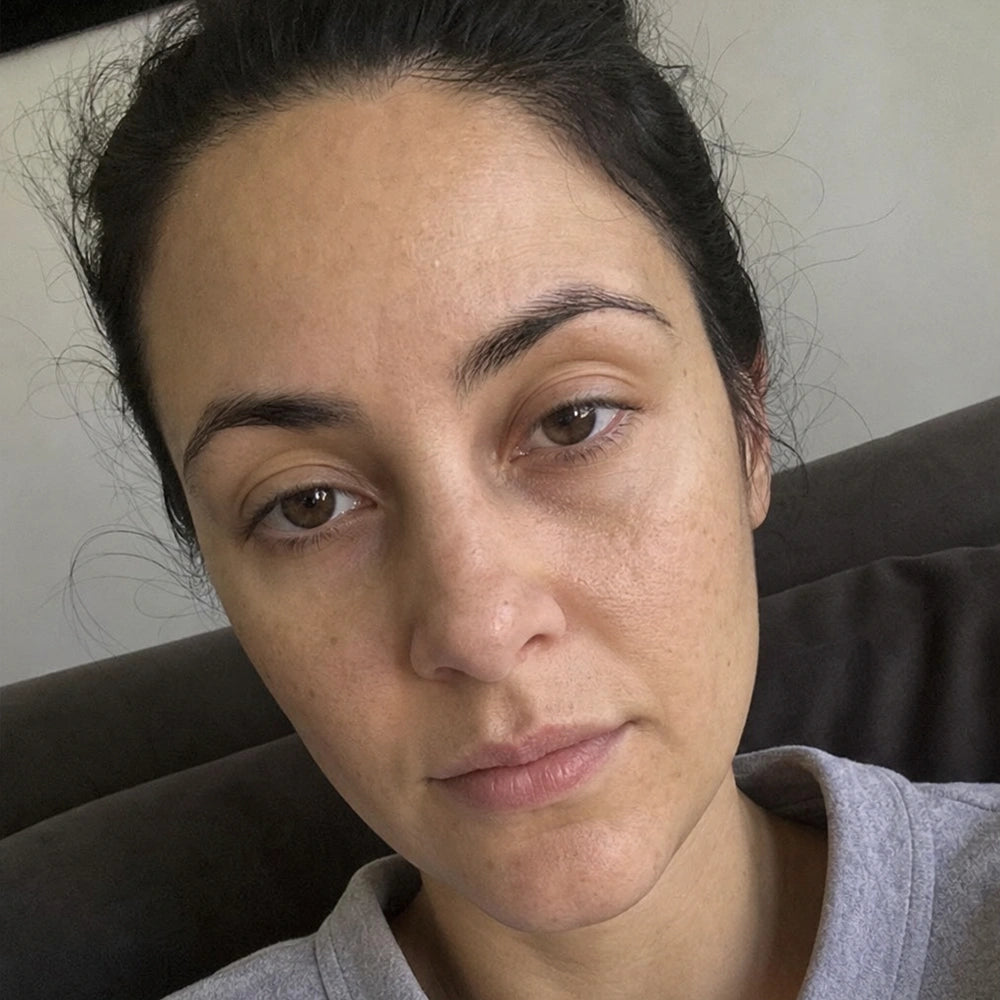 Linda, 30 — before, dull and tired skin