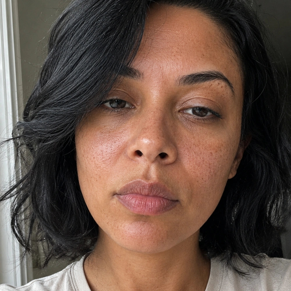 Mercy, 41 — before, uneven tone and marks