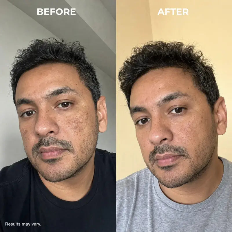 Korean Toner Pads