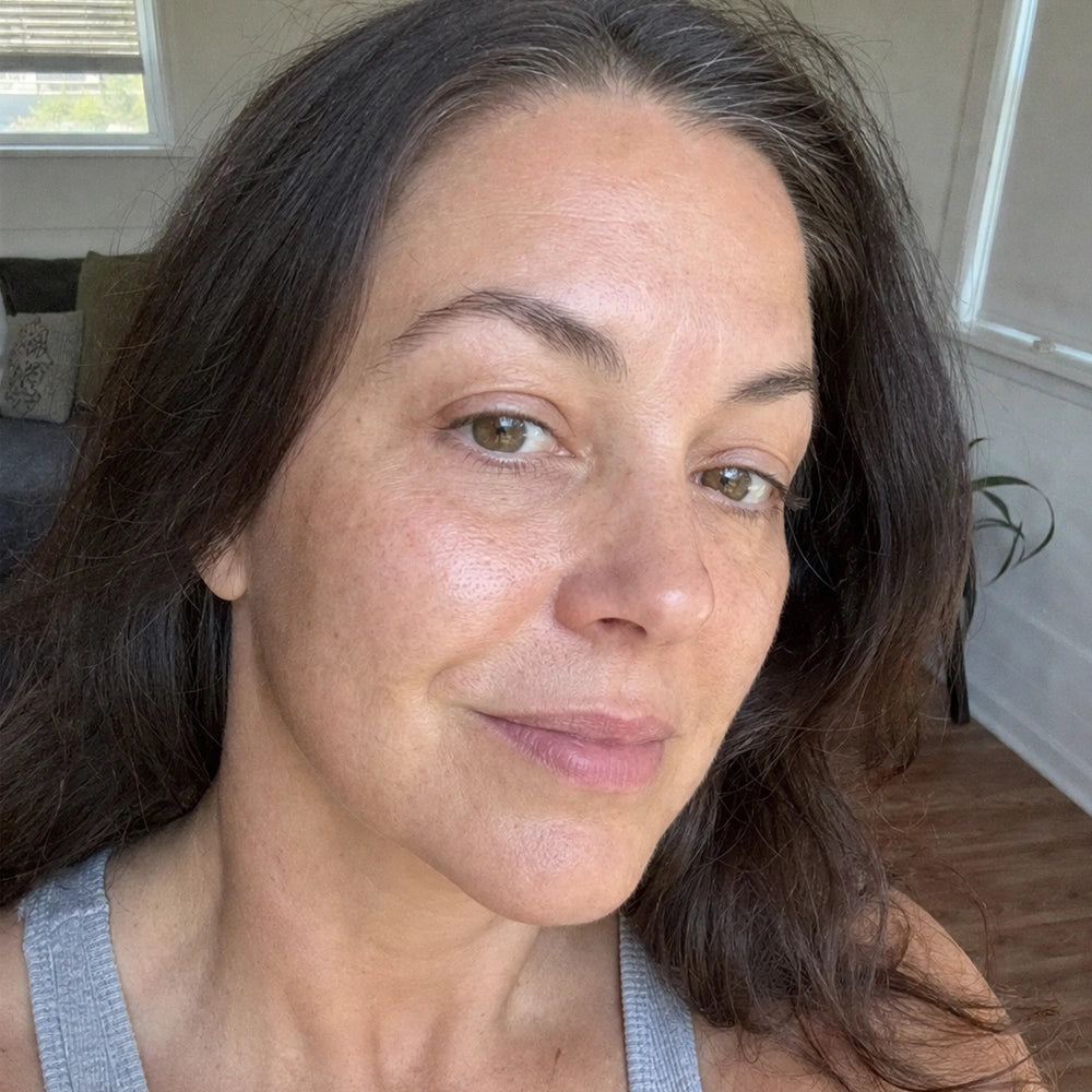 Suzaine, 44 — after 12 weeks, firmer jawline