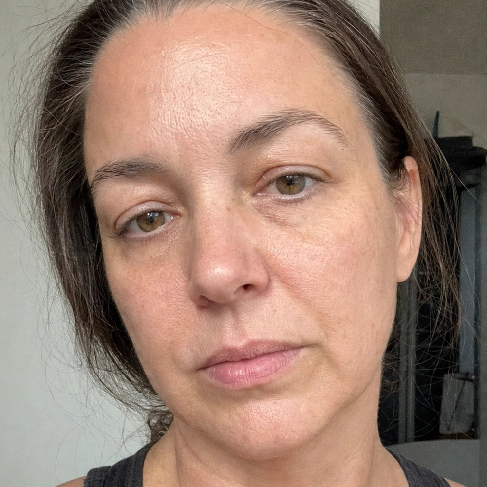 Suzaine, 44 — before, softening jawline