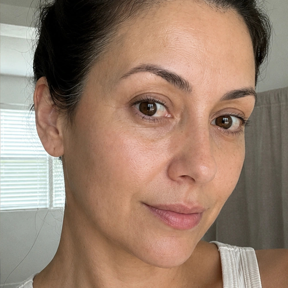 Suzaine, 45 — after 8 weeks, firmer, smoother