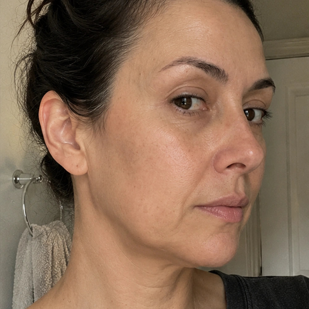 Suzaine, 45 — before, deeper nasolabial folds