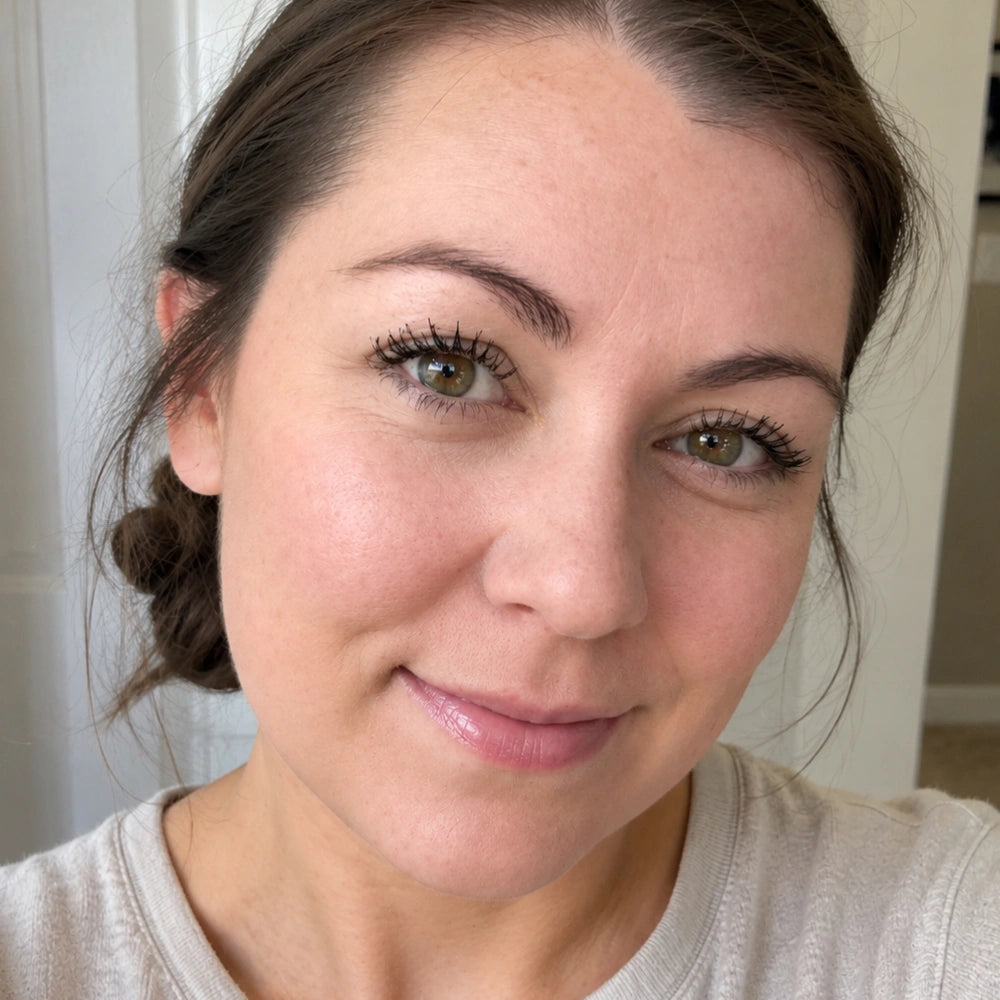 Tina, 35 — after 12 weeks, calmer, even skin