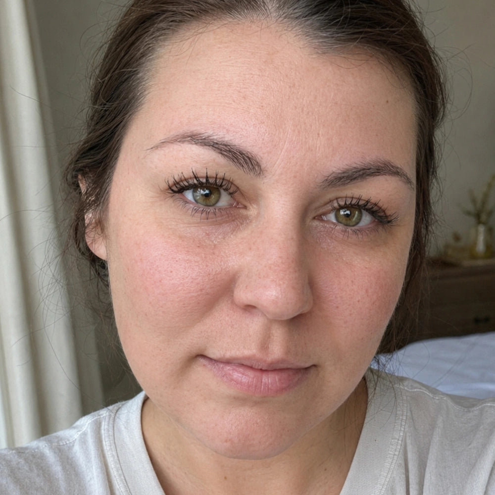 Tina, 35 — before, redness and irritation